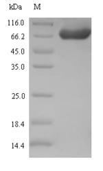 Recombinant Proteus mirabilis Serralysin(zapA)