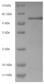 Recombinant Pseudomonas aeruginosa Beta-lactamase(ampC)