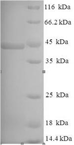 Recombinant Pseudomonas aeruginosa Lysyl endopeptidase(prpL)