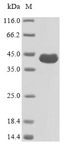 Recombinant Pseudomonas aeruginosa Outer membrane porin F(oprF)