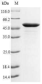 Recombinant Pseudomonas aeruginosa UDP-3-O-acyl-N-acetylglucosamine deacetylase(lpxC)
