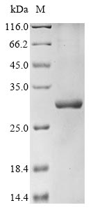 Recombinant Pseudomonas phage phi6 RNA-directed RNA polymerase(P2),partial