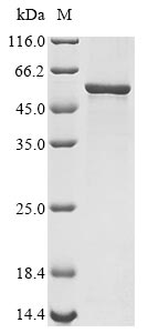 Recombinant Pseudomonas putida Phthalate 4,5-dioxygenase oxygenase subunit(pht3)