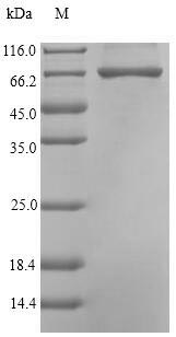 Recombinant Pseudomonas sp. Carboxypeptidase G2(cpg2)