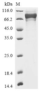 Recombinant Rabbit Dystroglycan(DAG1),partial
