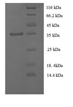 Recombinant Rabbit Tissue factor pathway inhibitor(TFPI)