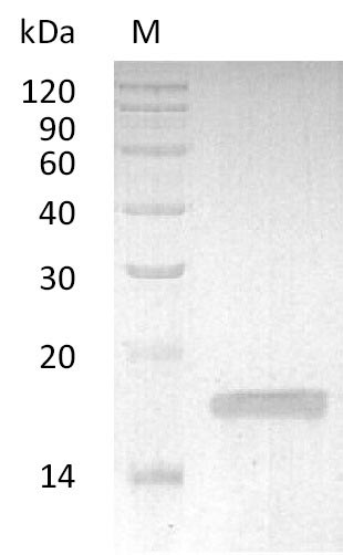 Recombinant Rabbit Tumor necrosis factor(TNF),partial (Active)