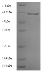 Recombinant Rabies virus  Glycoprotein(G),partial