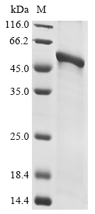 Recombinant Rabies virus Glycoprotein(G),partial