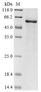 Recombinant Rabies virus Glycoprotein(G),partial