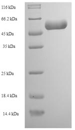 Recombinant Rabies virus Nucleoprotein(N)