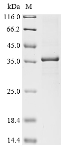 Recombinant Rat 17-beta-hydroxysteroid dehydrogenase 13(Hsd17b13)