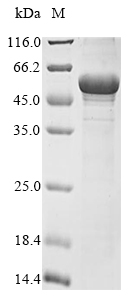 Recombinant Rat ATP synthase subunit beta, mitochondrial(Atp5f1b)