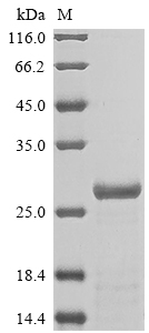 Recombinant Rat Alpha-1-acid glycoprotein(Orm1)