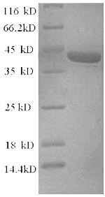 Recombinant Rat Alpha-synuclein(Snca)