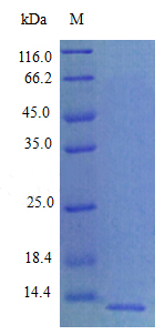 Recombinant Rat C-X-C motif chemokine 5 protein(Cxcl5) (Active)
