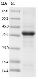 Recombinant Rat CMRF35-like molecule 1(Cd300lf),Partial