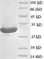 Recombinant Rat Calcium-dependent phospholipase A2(Pla2g5)
