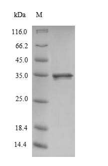 Recombinant Rat Calmodulin(Calm1)