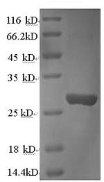 Recombinant Rat Cathepsin K(Ctsk)