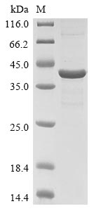 Recombinant Rat Chitinase-3-like protein 1(Chi3l1)