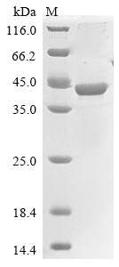 Recombinant Rat Chitinase-3-like protein 1(Chi3l1)