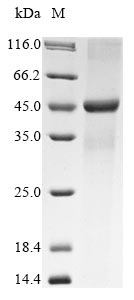 Recombinant Rat E3 ubiquitin-protein ligase TRIM63(Trim63)