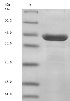 Recombinant Rat Ectonucleoside triphosphate diphosphohydrolase 1(Entpd1),partial