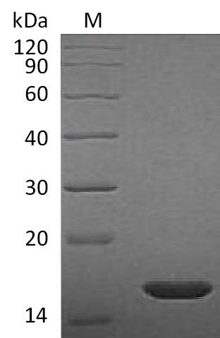 Recombinant Rat Fibroblast growth factor 2(Fgf2),partial (Active)