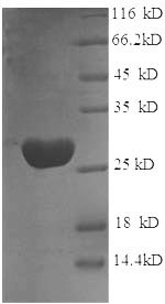 Recombinant Rat Glutathione S-transferase P(Gstp1)