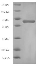 Recombinant Rat Glutathione S-transferase alpha-1(Gsta1)