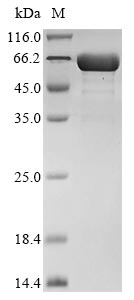 Recombinant Rat Interleukin-11(Il11),Biotinylated