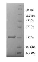 Recombinant Rat Major prion protein(Prnp)