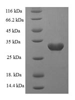 Recombinant Rat Sortilin(Sort1),partial