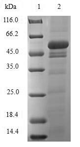 Recombinant Rat Sulfotransferase 1A1(Sult1a1)