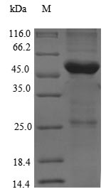 Recombinant Rat Thyroglobulin(Tg),partial