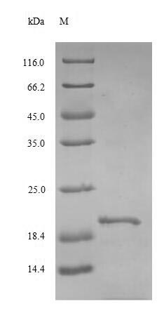 Recombinant Rat Thyrotropin subunit beta(Tshb)