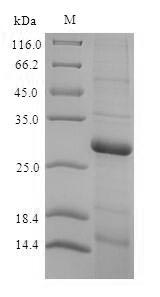Recombinant Rat Thyroxine 5-deiodinase(Dio3),partial(170:U→missing)