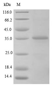 Recombinant Rat Transforming growth factor beta-1 proprotein(Tgfb1),partial