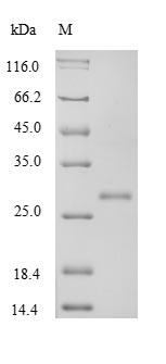 Recombinant Rat Transforming growth factor beta-1 proprotein(Tgfb1),partial