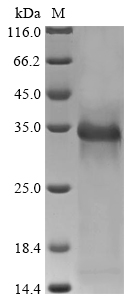Recombinant Rat Urokinase plasminogen activator surface receptor(Plaur) 