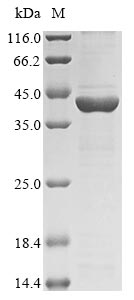 Recombinant Rauvolfia serpentina Strictosidine synthase(STR1)