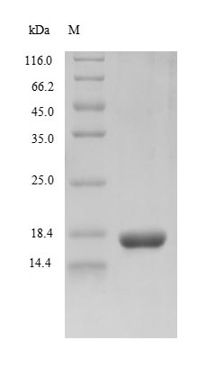 Recombinant Rhesus cytomegalovirus Envelope glycoprotein B(gB),partial
