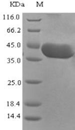 Recombinant Rift valley fever virus Nucleoprotein(N)