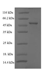 Recombinant Rotavirus A Intermediate capsid protein VP6