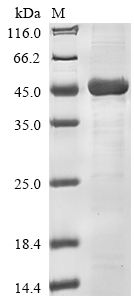 Recombinant Rotavirus A Intermediate capsid protein VP6