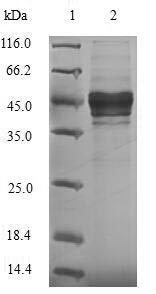Recombinant Rotavirus A Outer capsid glycoprotein VP7