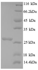 Recombinant Saccharomyces cerevisiae Chitin synthase 1(CHS1),partial