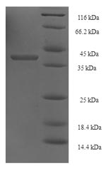 Recombinant Saccharomyces cerevisiae DNA repair and recombination protein RAD52(RAD52),partial
