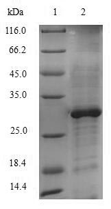 Recombinant Saccharomyces cerevisiae Lanosterol 14-alpha demethylase(ERG11),partial